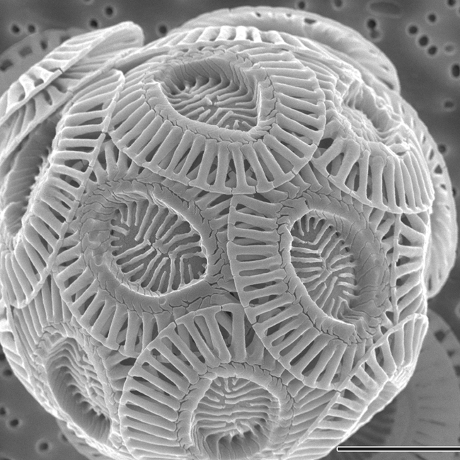 Elektronmikroskopi-bilde: Kilde: Wikimedia Commons/Alison R. Taylor (University of North Carolina Wilmington Microscopy Facility) - PLoS Biology